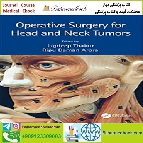 Operative Surgery for Head and Neck Tumors 2022