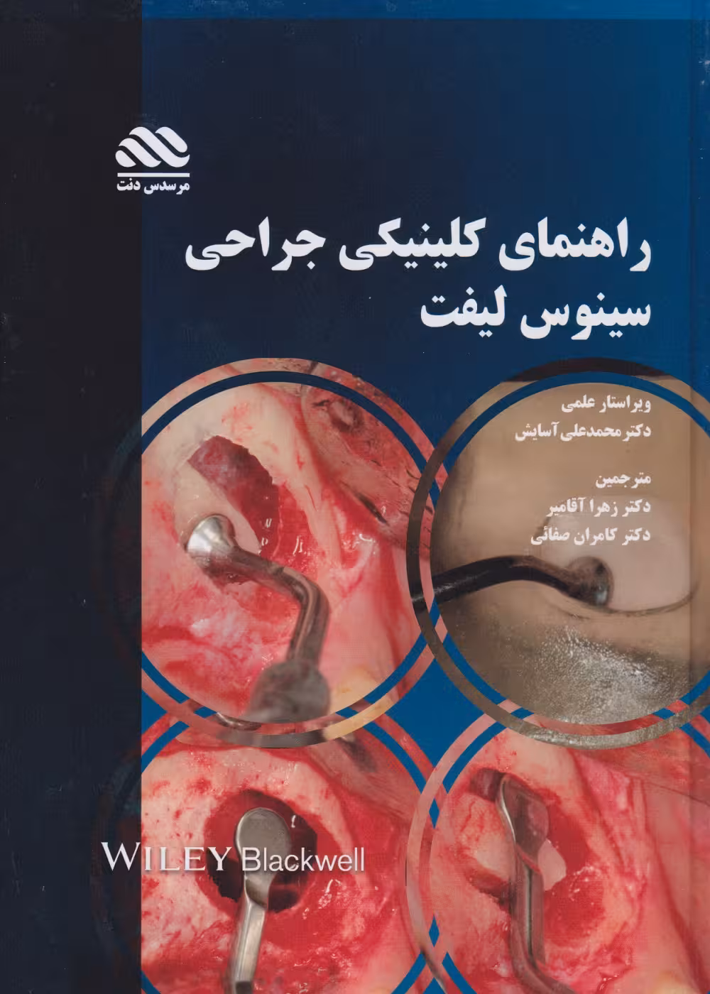 راهنمای کلینیکی جراحی سینوس لیفت