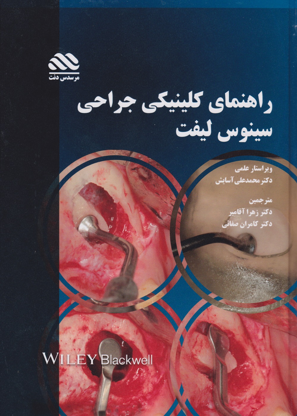 راهنمای کلینیکی جراحی سینوس لیفت