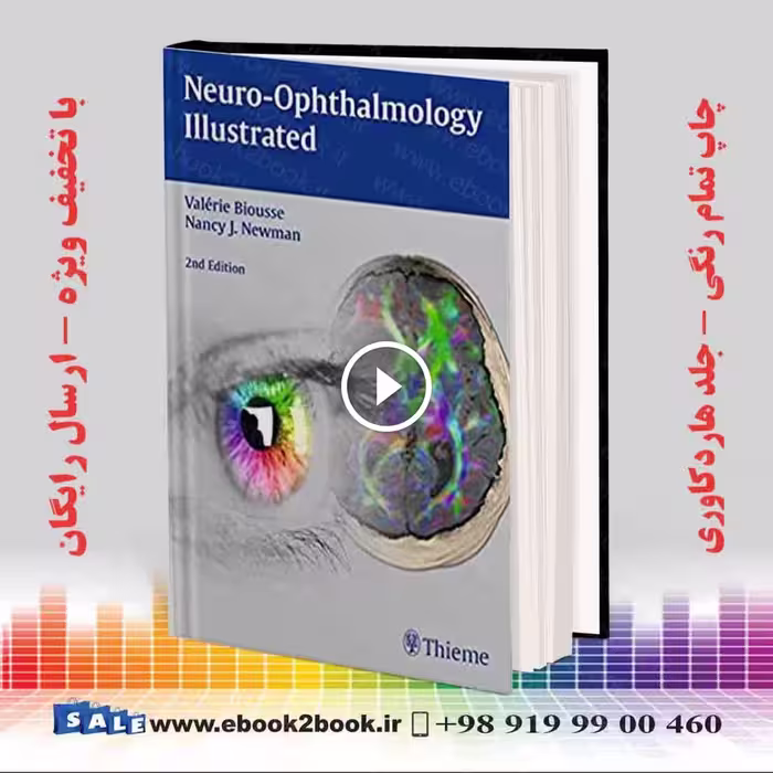 Neuro-Ophthalmology Illustrated 2nd Edition