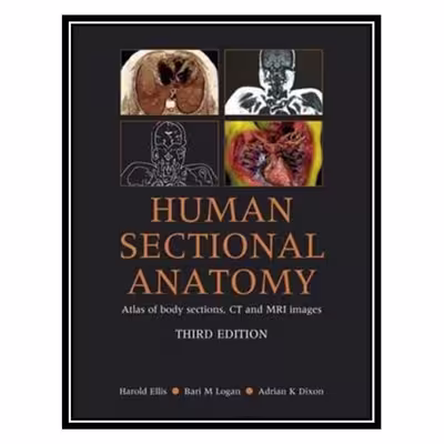 کتاب Human Sectional Anatomy: Atlas of Body Sections, CT and MRI Images, 3rd Edition اثر جمعی از نویسندگان انتشارات مؤلفین طلایی