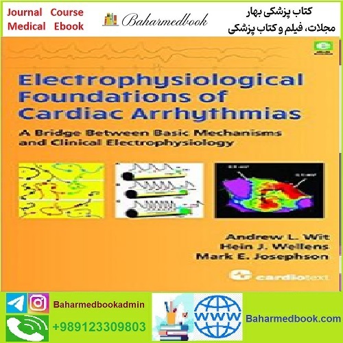 Electrophysiological Foundations of Cardiac Arrhythmias CON