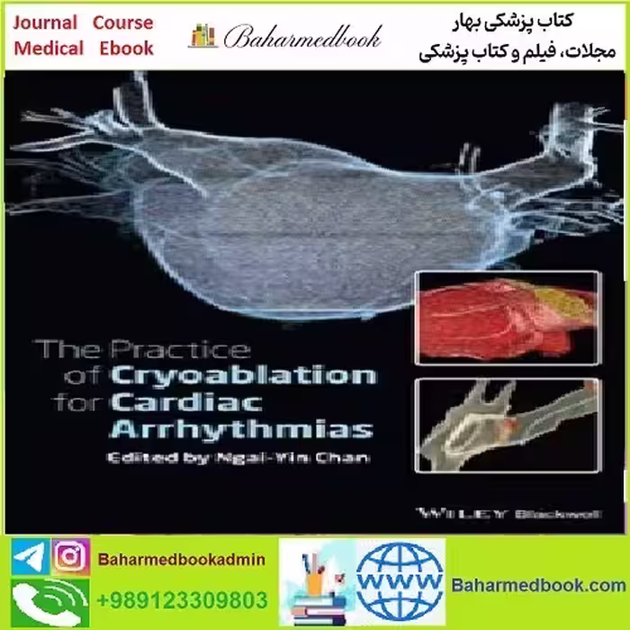 The Practice of Catheter Cryoablation for Cardiac Arrhythmias