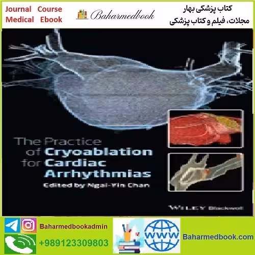The Practice of Catheter Cryoablation for Cardiac Arrhythmias