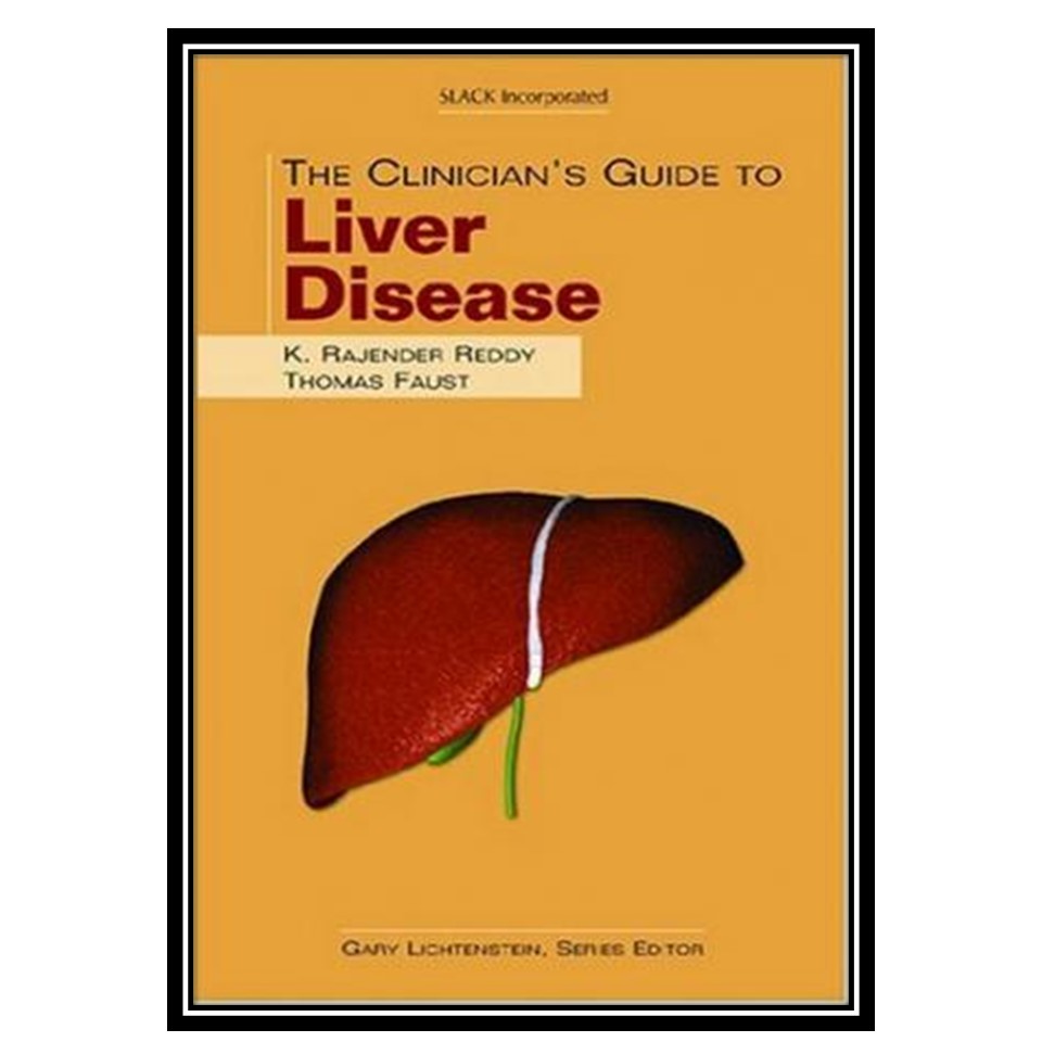 کتاب The Clinicians Guide to Liver Disease اثر K Rajender Reddy MD and Thomas Faust MD انتشارات مؤلفین طلایی
