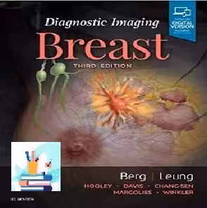 Diagnostic Imaging Breast TRUE PDF price 1€