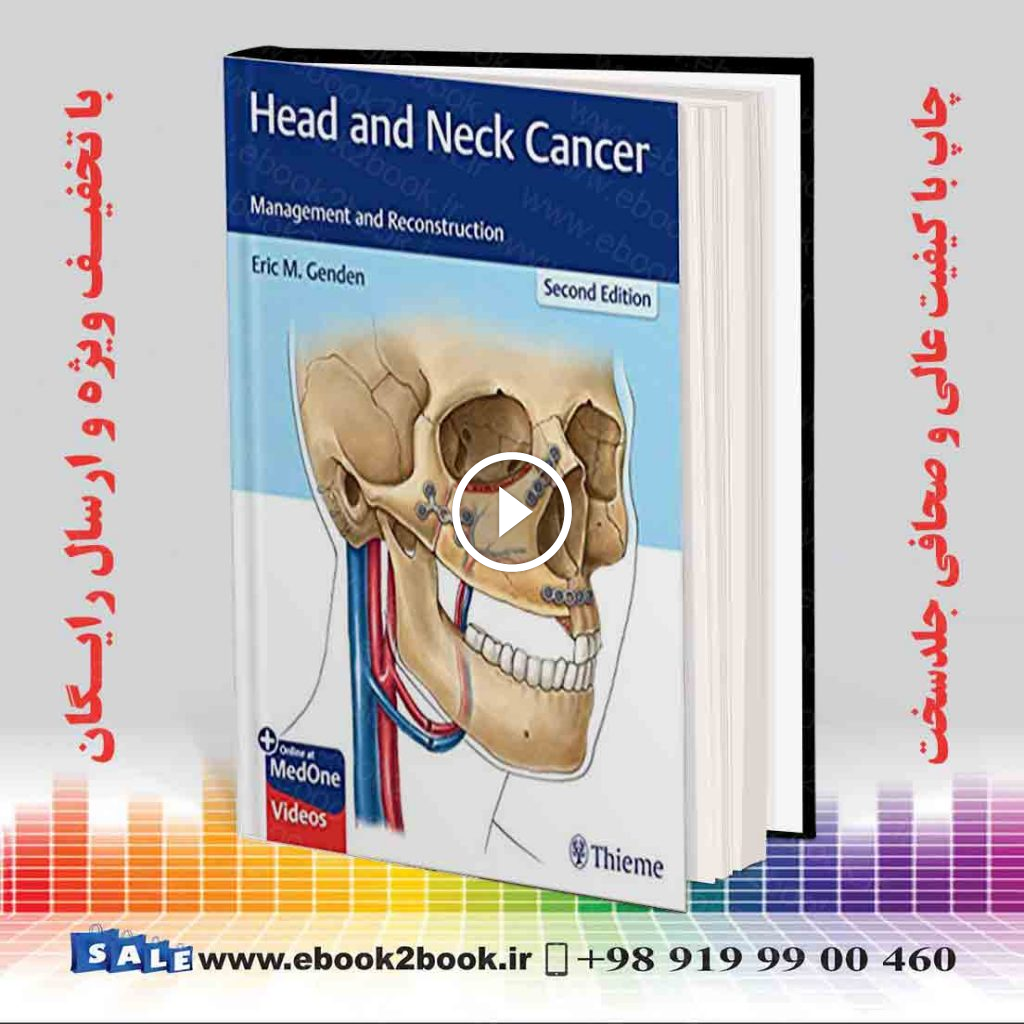 Head and Neck Cancer: Management and Reconstruction 2nd Edition