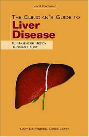 [PDF] دانلود کتاب The Clinician&#039;s Guide To Liver Disease, 2005
