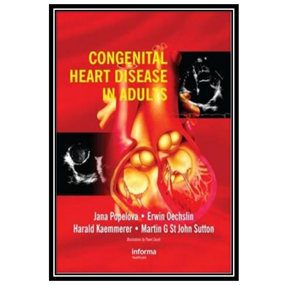 کتاب Congenital Heart Disease in Adults اثر جمعی از نویسندگان انتشارات مؤلفین طلایی