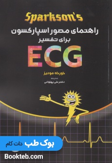 راهنمای مصور اسپارکسون برای تفسیر ECG
