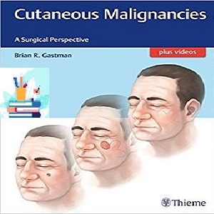Cutaneous Malignancies A Surgical Perspective 1ed PDF Video at 1€ - کتاب پزشکی بهار