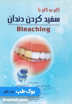 گام به گام با سفید کردن دندان