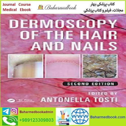 Dermoscopy of the Hair and Nails TRUE PDF price 1€ - کتاب پزشکی بهار