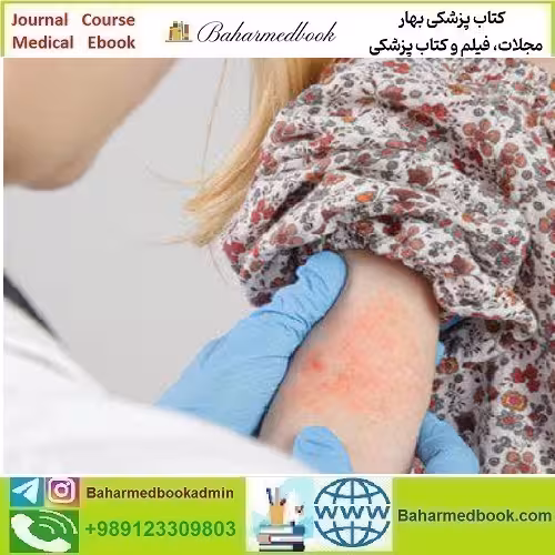 Dermatology for Primary Care 2022 video course price 35€ - کتاب پزشکی بهار