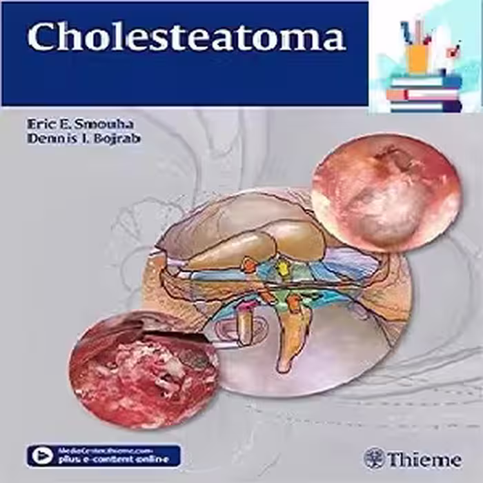 Cholesteatoma 1ed PDF Videos at 2€ - کتاب پزشکی بهار