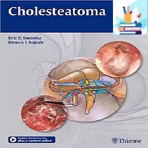 Cholesteatoma 1ed PDF Videos at 2€ - کتاب پزشکی بهار