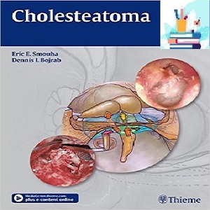 Cholesteatoma 1ed PDF Videos at 2€ - کتاب پزشکی بهار