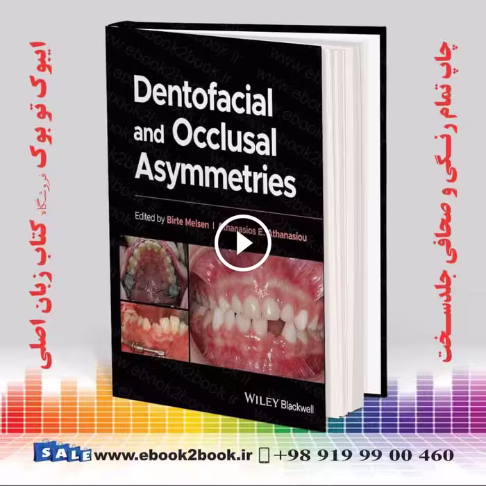Dentofacial and Occlusal Asymmetries