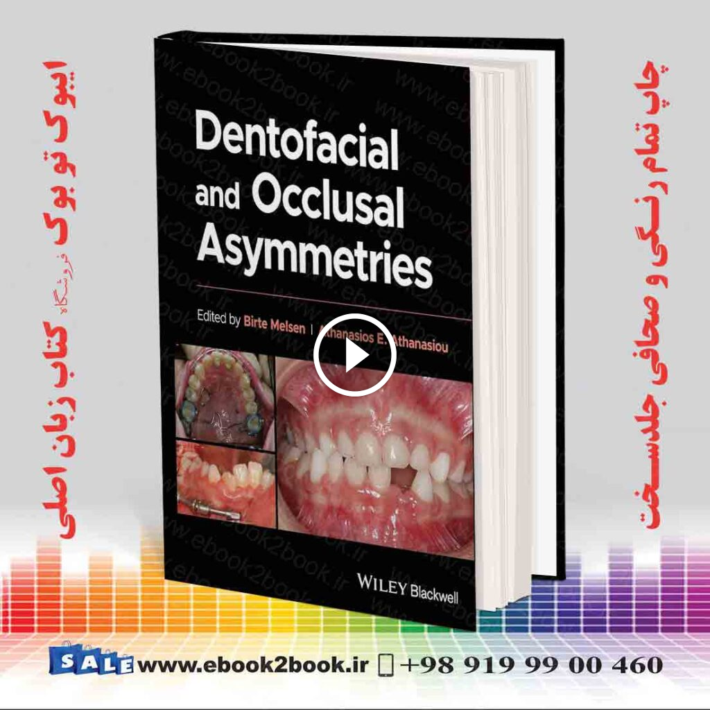 Dentofacial and Occlusal Asymmetries