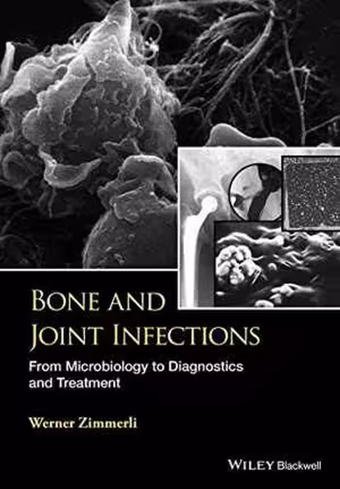 [PDF] دانلود کتاب Bone And Joint Infections - From Microbiology To Diagnostics And Treatment, 2015