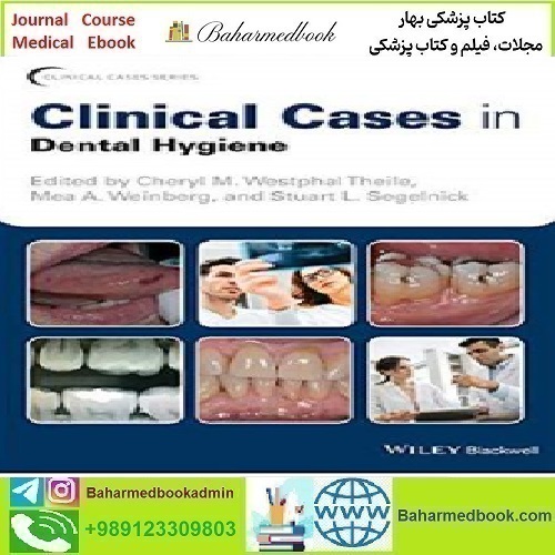 Clinical Cases in Dental Hygiene 2019 TRUE PDF price 1€ - کتاب پزشکی بهار