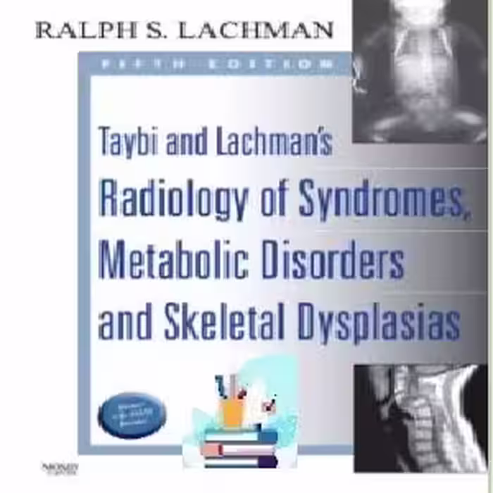 Radiology of Syndromes Metabolic Disorders and Skeletal Dyspla