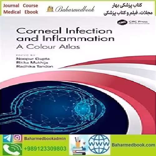 Corneal Infection and Inflammation 2021 TRUE PDF price 1€ - کتاب پزشکی بهار