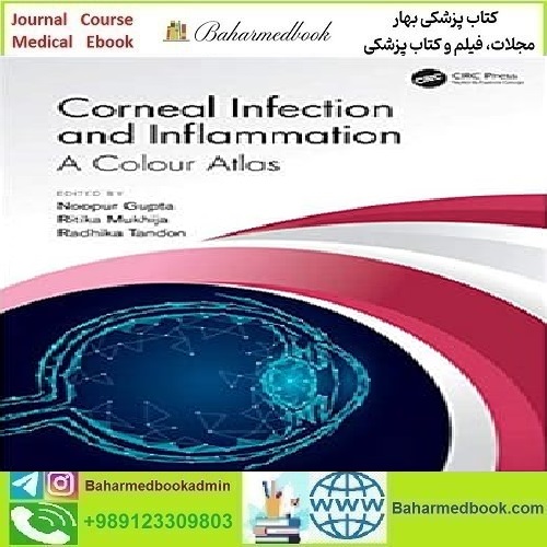 Corneal Infection and Inflammation 2021 TRUE PDF price 1€ - کتاب پزشکی بهار