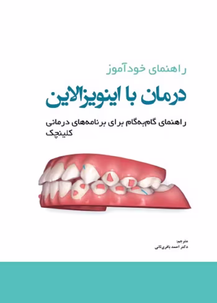 راهنمای خودآموز درمان با اینویزالاین راهنمای گام به گام برای برنامه های درمانی کلینچک