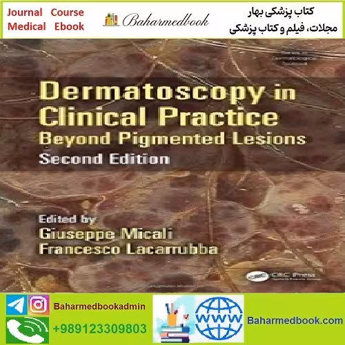 Dermatoscopy in Clinical Practice Beyond Pigmented Lesions T