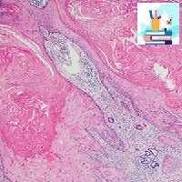 Dermatopathology 2020-Videos PDFs at 25€ - کتاب پزشکی بهار