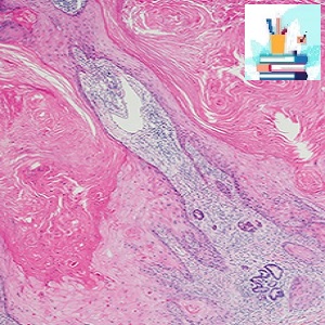 Dermatopathology 2020-Videos PDFs at 25€ - کتاب پزشکی بهار