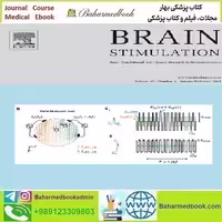 Brain Stimulation Volume 17 Issue 1 2024 TRUE PDF price 8€ - کتاب پزشکی بهار