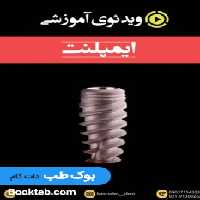 ویدئوی آموزشی ایمپلنت جامع (انگلیسی)
