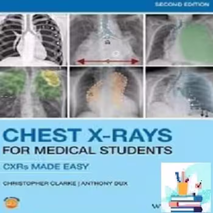 Chest X-Rays for Medical Students TRUE PDF price 1€ - کتاب پزشکی بهار