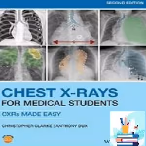 Chest X-Rays for Medical Students TRUE PDF price 1€ - کتاب پزشکی بهار
