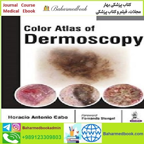 Color Atlas of Dermoscopy TRUE PDF price 1€ - کتاب پزشکی بهار