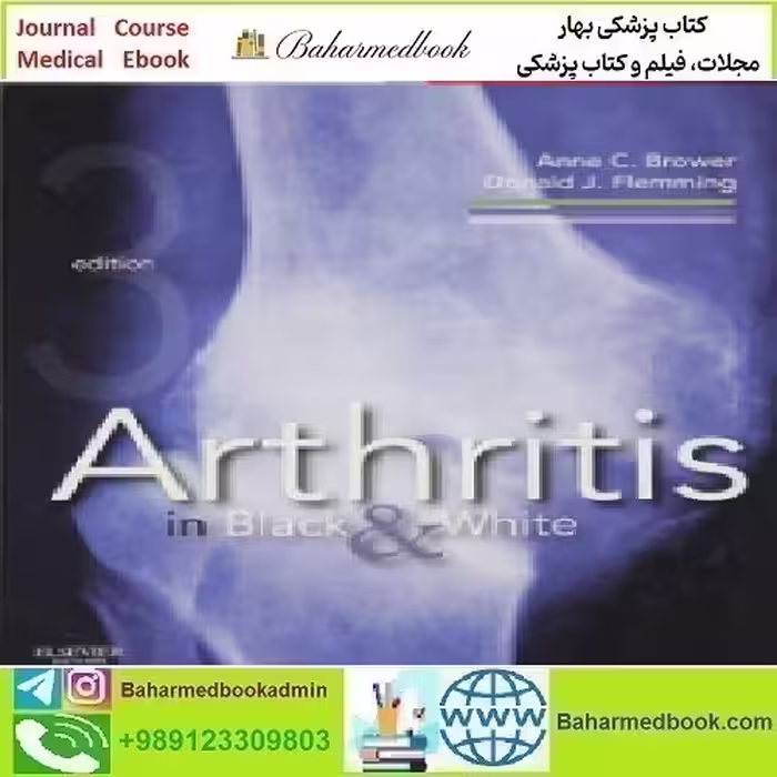 Arthritis in Black and White Expert Consult 2012 TRUE PDF p
