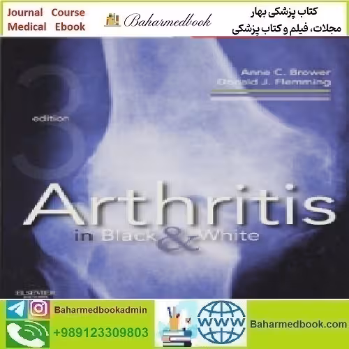 Arthritis in Black and White Expert Consult 2012 TRUE PDF p