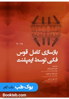 بازسازی کامل قوس فکی توسط ایمپلنت 2019