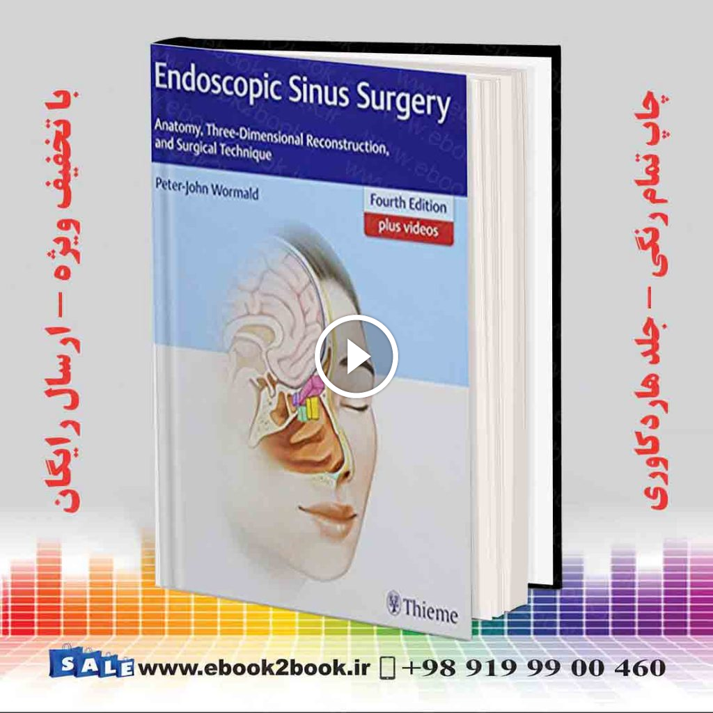 Endoscopic Sinus Surgery 4th Edition