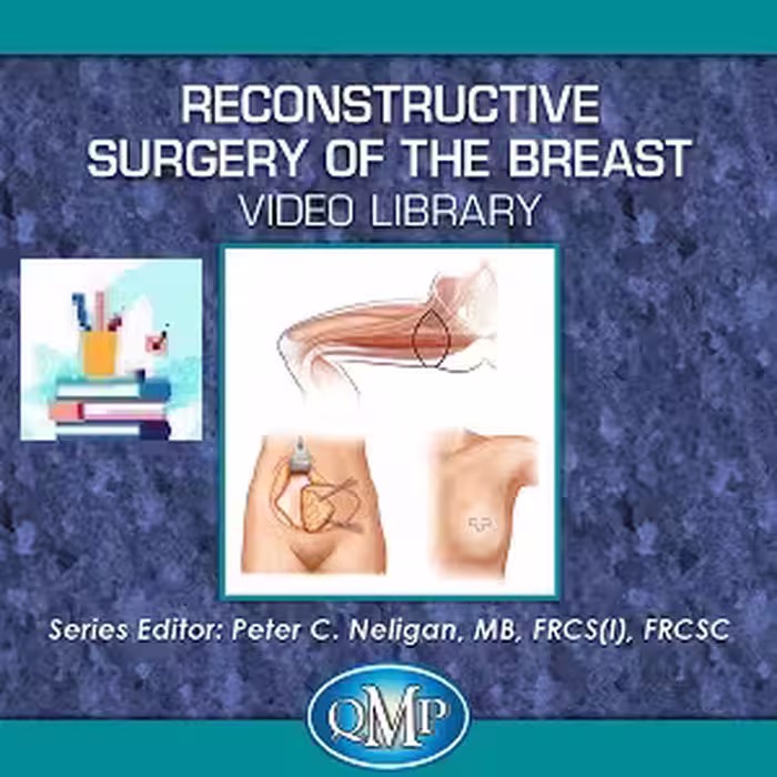 Reconstructive Surgery of the Breast VIDEO Library Price 20€