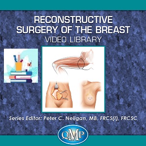 Reconstructive Surgery of the Breast VIDEO Library Price 20€