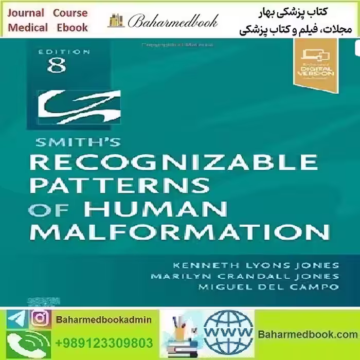 Smith’s Recognizable Patterns Of Human Malformation 2021 T