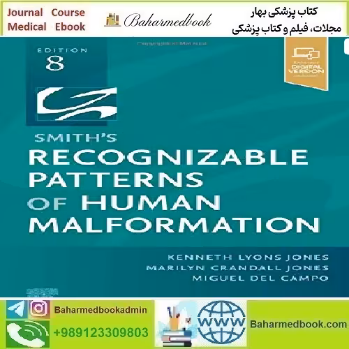 Smith’s Recognizable Patterns Of Human Malformation 2021 T