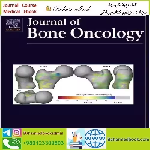 Journal of Bone Oncology 2021-2024 Full Archives TRUE PDF