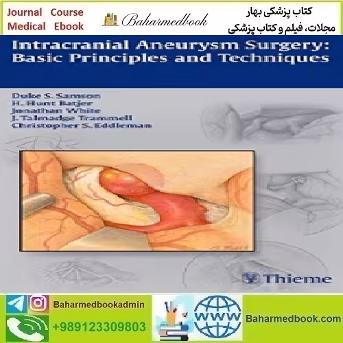 Intracranial Aneurysm Surgery Basic Principles and Techniques 2