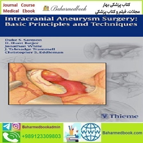 Intracranial Aneurysm Surgery Basic Principles and Techniques 2