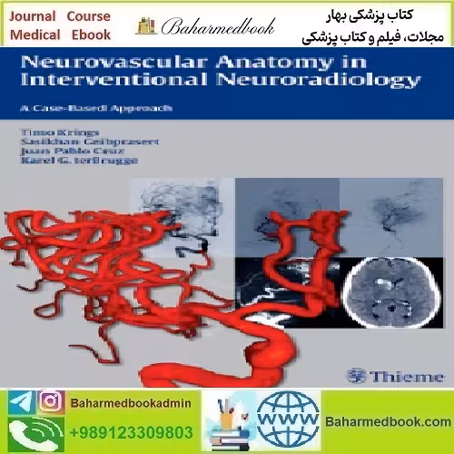 Neurovascular Anatomy in Interventional Neuroradiolog