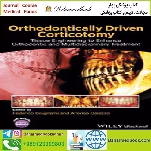 Orthodontically Driven Corticotomy 2015 TRUE PDF price 1€ - کتاب پزشکی بهار